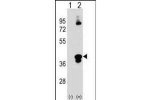Western blot analysis of C1QTNF1 (arrow) using rabbit polyclonal C1QTNF1 Antibody (N-term) (ABIN390541 and ABIN2840881). (C1QTNF1 抗体  (N-Term))