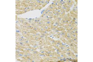 Immunohistochemistry of paraffin-embedded mouse heart using INPP5J Antibody (ABIN5973988) at dilution of 1/100 (40x lens). (INPP5J 抗体)