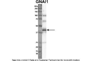 Sample Type: Nthy-ori cell lysate (50ug)Primary Dilution: 1:1000Secondary Antibody: anti-rabbit HRPSecondary Dilution: 1:2000Image Submitted By: Anonymous (GNAI1 抗体  (Middle Region))