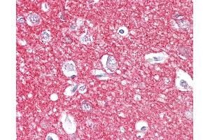 Anti-Amphiphysin antibody IHC of human brain, cortex. (Amphiphysin 抗体  (AA 1-347))