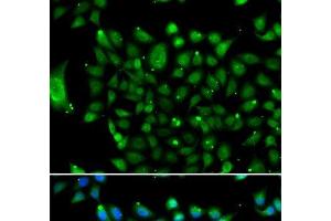 Immunofluorescence analysis of U2OS cells using NCOR1 Polyclonal Antibody (NCOR1 抗体)