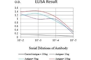 Black line: Control Antigen (100 ng),Purple line: Antigen (10 ng), Blue line: Antigen (50 ng), Red line:Antigen (100 ng) (Cytokeratin 13 抗体  (AA 104-458))