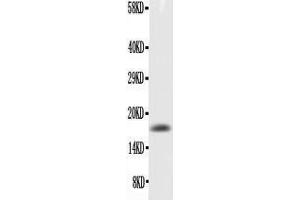 Anti-GM-CSF Picoband antibody,  All lanes: Anti-GM-CSF at 0. (GM-CSF 抗体  (AA 18-141))
