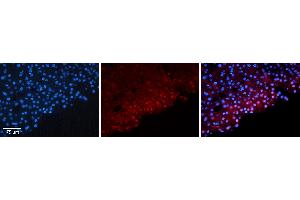 Rabbit Anti-FOSB Antibody   Formalin Fixed Paraffin Embedded Tissue: Human Liver Tissue Observed Staining: Nucleus in hepatocytes Primary Antibody Concentration: 1:100 Other Working Concentrations: N/A Secondary Antibody: Donkey anti-Rabbit-Cy3 Secondary Antibody Concentration: 1:200 Magnification: 20X Exposure Time: 0. (FOSB 抗体  (N-Term))