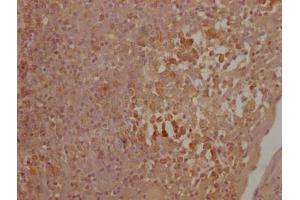 Immunohistochemistry (IHC) image for anti-Cytotoxic T-Lymphocyte-Associated Protein 4 (CTLA4) (AA 37-162) antibody (ABIN7149430)