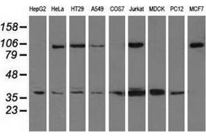 Western blot analysis of extracts (35 µg) from 9 different cell lines by using anti-XRCC1 monoclonal antibody. (XRCC1 抗体)