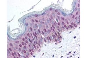 affinity purified anti-HMGN pS20/pS24 antibody was used at 20 ug/ml to detect signal in a variety of tissues including multi-human, multi-brain and multi-cancer slides. (HMGN1 抗体  (pSer20, pSer24))