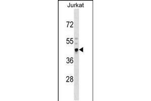 Western blot analysis in Jurkat cell line lysates (35ug/lane). (CRELD2 抗体  (N-Term))