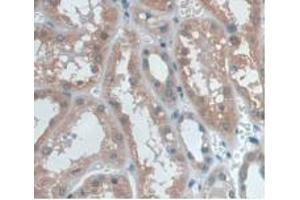 DAB staining on IHC-P; Samples: Human Kidney Tissue. (UCP2 抗体  (AA 154-289))