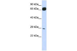 PRTFDC1 antibody used at 1 ug/ml to detect target protein. (PRTFDC1 抗体  (N-Term))
