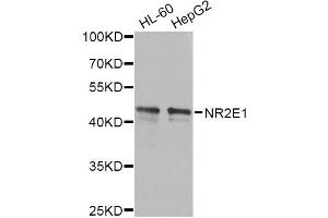 Western blot analysis of extracts of various cell lines, using NR2E1 antibody (ABIN6290680) at 1:1000 dilution. (NR2E1 抗体)