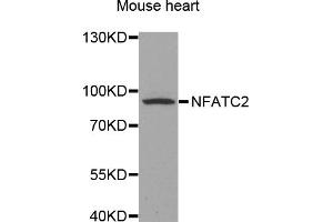 Western blot analysis of extracts of mouse heart, using NFATC2 antibody (ABIN5971589) at 1/500 dilution. (NFAT1 抗体)