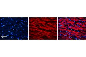 Rabbit Anti-MSRA Antibody Catalog Number: ARP56732_P050 Formalin Fixed Paraffin Embedded Tissue: Human heart Tissue Observed Staining: Cytoplasmic Primary Antibody Concentration: N/A Other Working Concentrations: 1:600 Secondary Antibody: Donkey anti-Rabbit-Cy3 Secondary Antibody Concentration: 1:200 Magnification: 20X Exposure Time: 0. (MSRA 抗体  (Middle Region))