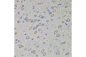 Immunohistochemistry of paraffin-embedded rat brain using PTCD3 antibody. (PTCD3 抗体  (AA 450-689))