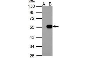 WB Image IP6K1 antibody detects IP6K1 protein by western blot analysis. (IP6K1 抗体)