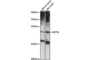Western blot analysis of extracts of various cell lines, using NICN1 antibody (ABIN6293891) at 1:1000 dilution. (NICN1 抗体)