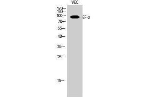 Western Blotting (WB) image for anti-Eukaryotic Translation Elongation Factor 2 (EEF2) (Ser311) antibody (ABIN3184410) (EEF2 抗体  (Ser311))