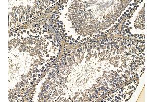 ABIN7095517 and ABIN7099574 at 1/100 staining rat testis tissue by IHC-P.