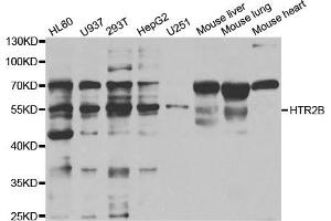 Western Blotting (WB) image for anti-Serotonin Receptor 2B (HTR2B) antibody (ABIN1876871) (Serotonin Receptor 2B 抗体)