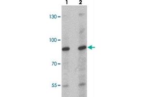 Western blot analysis of NCBP1 in HeLa cell lysate with NCBP1 polyclonal antibody  at (lane 1) 1 and (lane 2) 2 ug/mL. (NCBP1 抗体  (Internal Region))