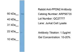 Western Blotting (WB) image for anti-Prefoldin Subunit 2 (PFDN2) (Middle Region) antibody (ABIN2786872) (PFDN2 抗体  (Middle Region))
