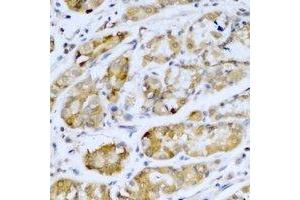 Immunohistochemical analysis of SETD5 staining in human stomach formalin fixed paraffin embedded tissue section. (SETD5 抗体)