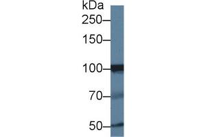Western blot analysis of Human Jurkat cell lysate, using Human INPP4A Antibody (1 µg/ml) and HRP-conjugated Goat Anti-Rabbit antibody ( (INPP4A 抗体  (AA 1-137))