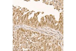 Immunohistochemistry of paraffin-embedded human colon carcinoma using [KO Validated]  Rabbit mAb (ABIN7271243) at dilution of 1:100 (40x lens). (AKT1 抗体)