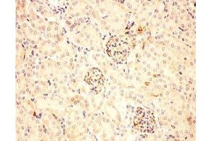 IHC-P: ACTH antibody testing of mouse kidney tissue (ACTH 抗体  (Middle Region))