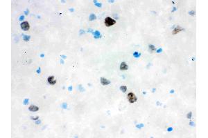 Anti- VCP Picoband antibody, IHC(F): Rat Brain Tissue (VCP 抗体  (C-Term))