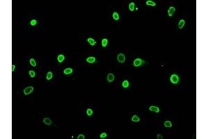 Immunofluorescence staining of Hela cells (treated with 30mM sodium butyrate for 4h) with ABIN7139175 at 1:5, counter-stained with DAPI. (HIST1H3A 抗体  (acLys27))
