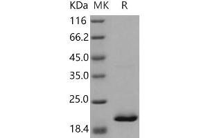 Retinol Binding Protein 4, Plasma (RBP4) (Active) protein (His tag)