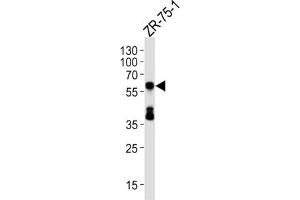 Western Blotting (WB) image for anti-delta Like Protein 3 (DLL3) antibody (ABIN5024655) (DLL3 抗体)