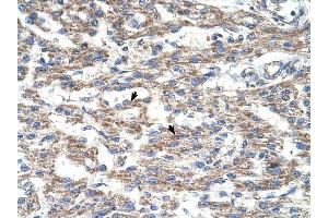 DUT antibody was used for immunohistochemistry at a concentration of 4-8 ug/ml to stain Myocardial cells (arrows) in Human Heart. (Deoxyuridine Triphosphatase (DUT) (C-Term) 抗体)