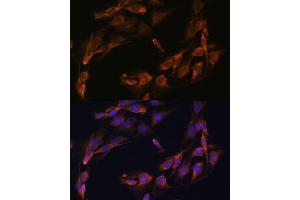 Immunofluorescence (IF) image for anti-Osteocalcin (BGLAP) (AA 1-100) antibody (ABIN6137546)
