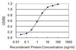 Detection limit for recombinant GST tagged SEPT9 is 0. (Septin 9 抗体  (AA 26-125))