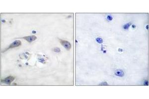 Immunohistochemistry analysis of paraffin-embedded human brain tissue, using DARPP-32 (Ab-75) Antibody. (DARPP32 抗体  (AA 41-90))