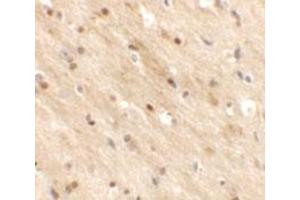 Immunohistochemical analysis of TMEM59L in mouse brain tissue with TMEM59L polyclonal antibody  at 2.