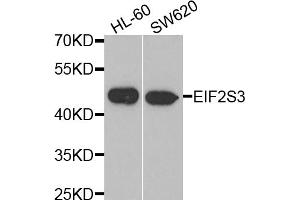 Western blot analysis of extracts of various cell lines, using EIF2S3 antibody (ABIN5975415) at 1/1000 dilution. (EIF2S3 抗体)