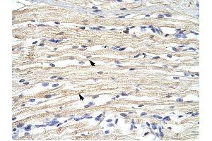 FBXL11 antibody was used for immunohistochemistry at a concentration of 4-8 ug/ml to stain Skeletal muscle cells (arrows) in Human Muscle. (KDM2A 抗体  (N-Term))