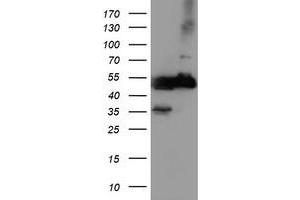 Western Blotting (WB) image for anti-Tubulin, alpha-Like 3 (TUBAL3) (AA 150-446) antibody (ABIN1490960) (TUBAL3 抗体  (AA 150-446))