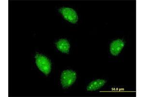 Immunofluorescence of monoclonal antibody to FLI1 on HeLa cell. (FLI1 抗体  (AA 1-452))