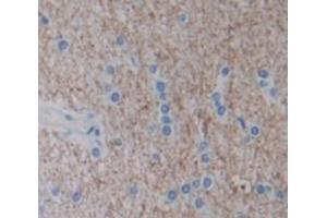 IHC-P analysis of Human Tissue, with DAB staining. (IFNA5 抗体  (AA 22-189))