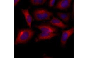 Immunofluorescenitrocellulosee of human HeLa cells stained with Hoechst 3342 (Blue) for nucleus staining and monoclonal anti-human BAK1 antibody (1:500) with Texas Red (Red). (BAK1 抗体  (AA 29-187))