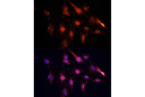 Immunofluorescence analysis of C6 cells using NSUN2 antibody (ABIN1681117, ABIN3017797, ABIN3017798 and ABIN6220260) at dilution of 1:100. (NSUN2 抗体  (AA 508-767))