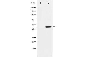 Western blot analysis of Tyrosine Hydroxylase phosphorylation expression in Insulin treated 293 whole cell lysates,The lane on the left is treated with the antigen-specific peptide. (Tyrosine Hydroxylase 抗体  (pSer19))