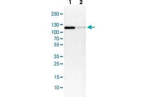 Western Blot (Cell lysate) analysis with CTNND1 polyclonal antibody  Lane 1: NIH-3T3 cell lysate (Mouse embryonic fibroblast cells) Lane 2: NBT-II cell lysate (Rat Wistar bladder tumour cells) (CTNND1 抗体)