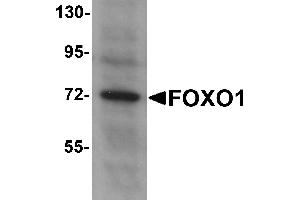 Western Blotting (WB) image for anti-Forkhead Box O1 (FOXO1) (N-Term) antibody (ABIN1031383) (FOXO1 抗体  (N-Term))