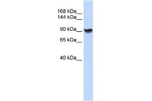 WB Suggested Anti-ACTN1 Antibody Titration: 0. (ACTN1 抗体  (N-Term))