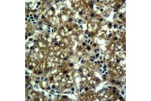 Immunohistochemical analysis of EPG5 staining in mouse liver formalin fixed paraffin embedded tissue section. (EPG5 抗体)